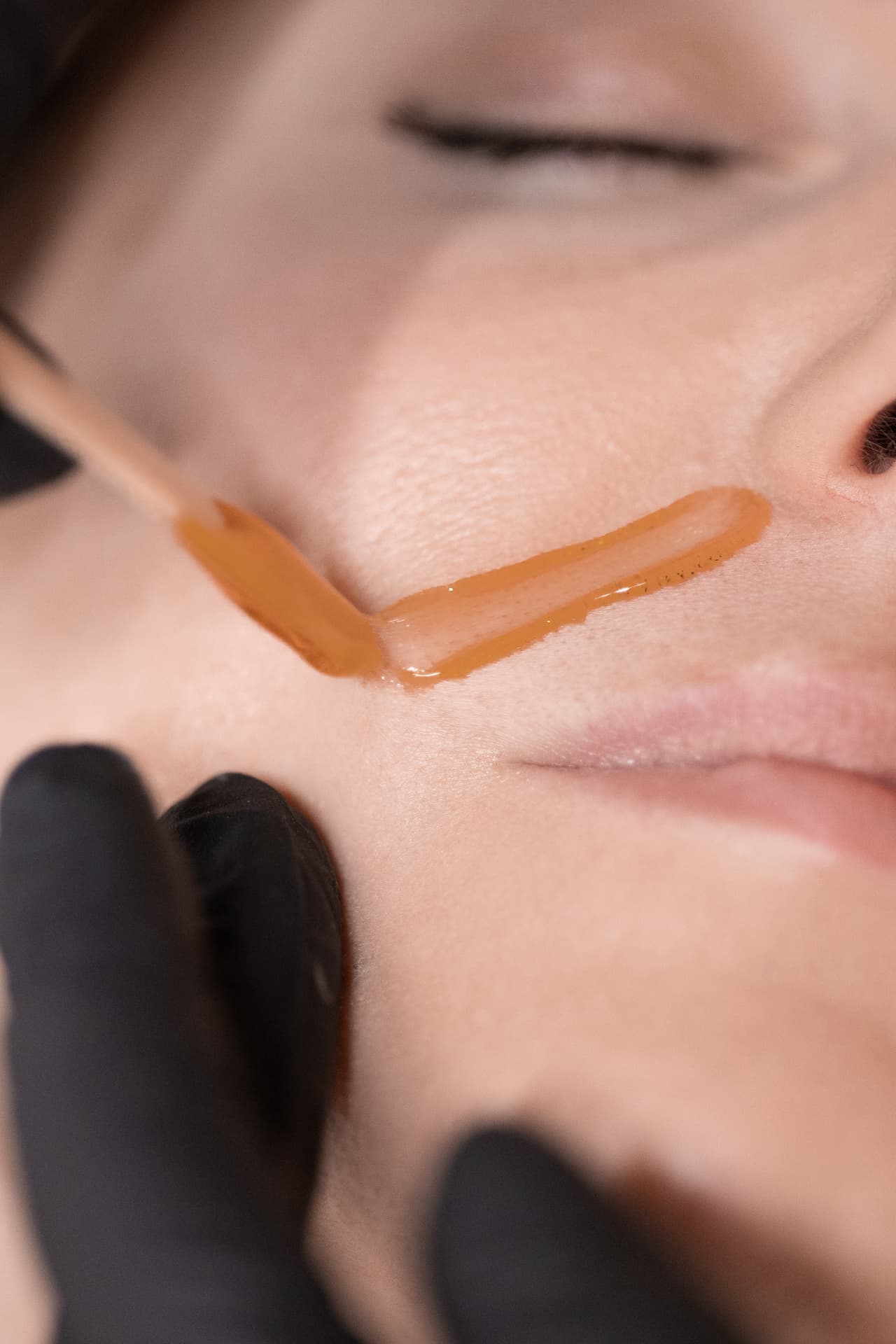 Depilacja twarzy woskiem w Białymstoku — nakładanie wosku w okolicy wąsika w salonie SKiN
